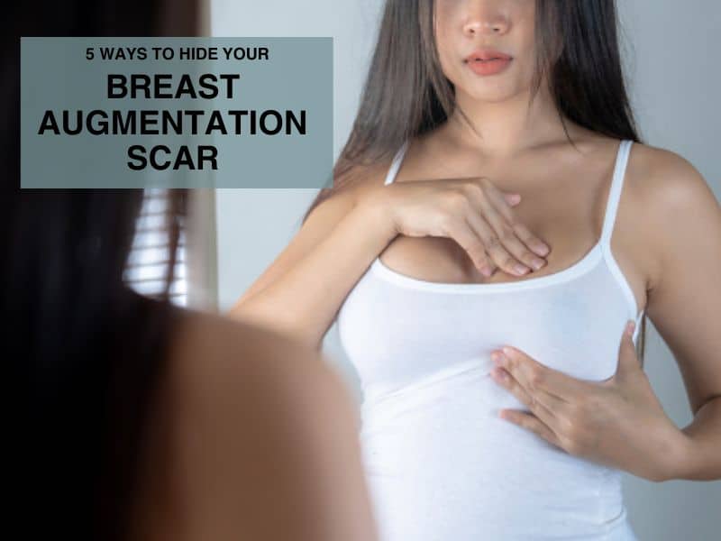 5 Ways to Hide Your Breast Augmentation Scar