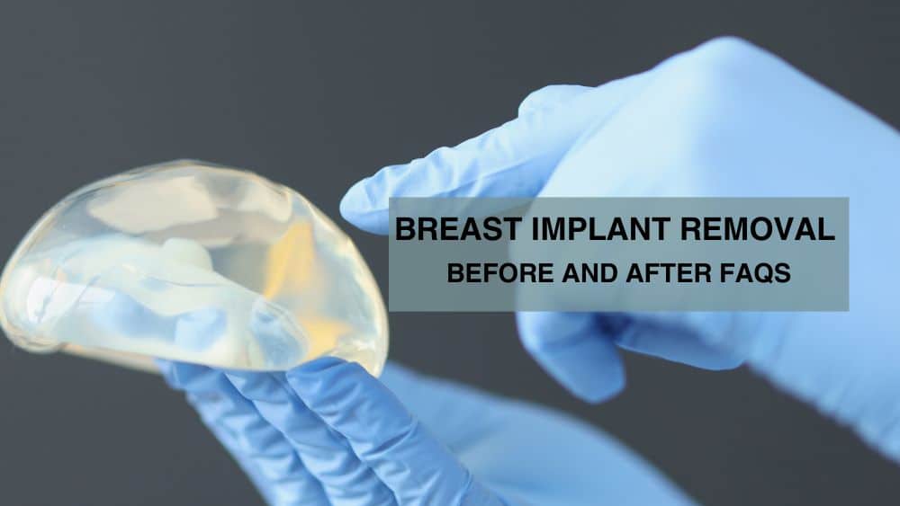 Breast Implant Removal Before and After FAQs