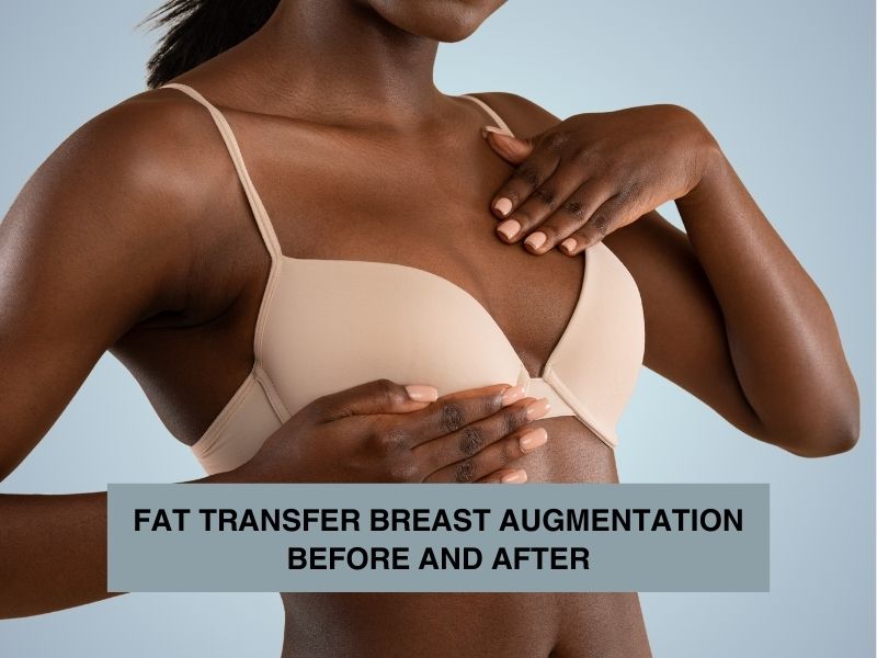 FAT TRANSFER BREAST AUGMENTATION BEFORE AND AFTER