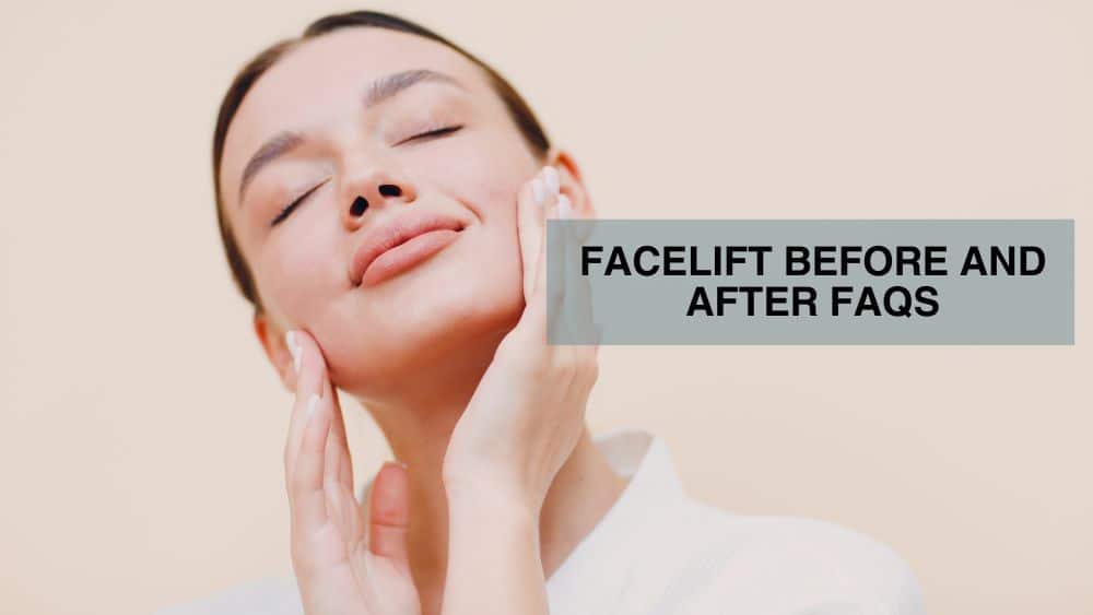 Facelift Before and After FAQs