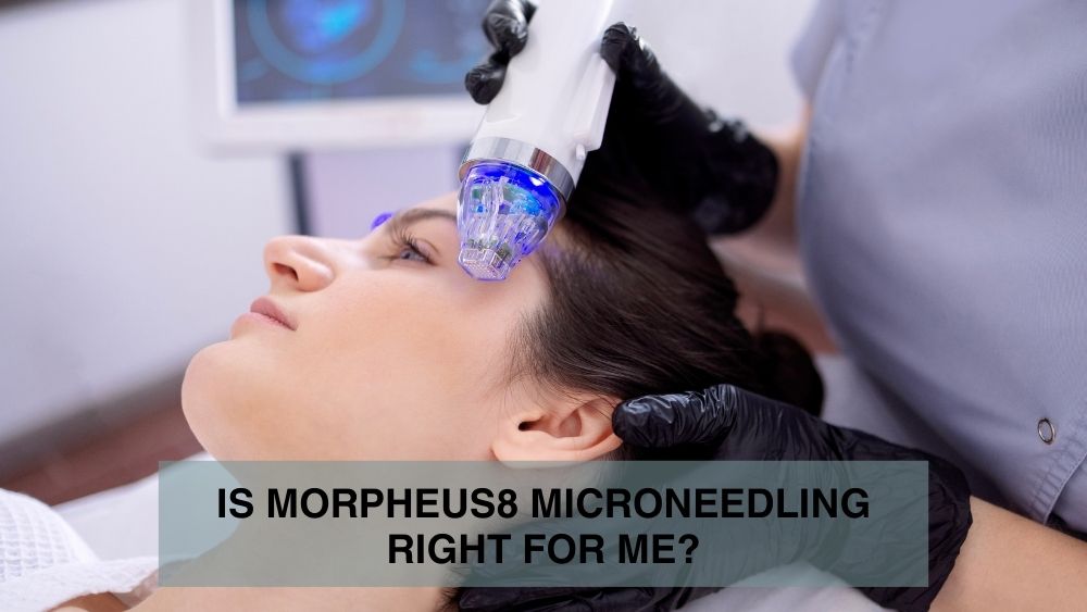 Is Morpheus8 Microneedling Right for Me