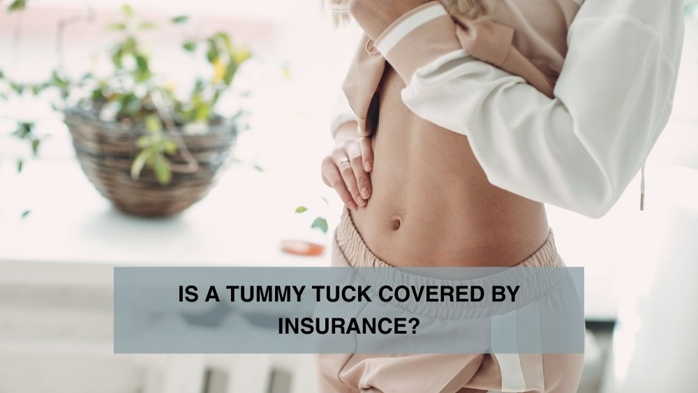 /Is a Tummy Tuck Covered by Insurance