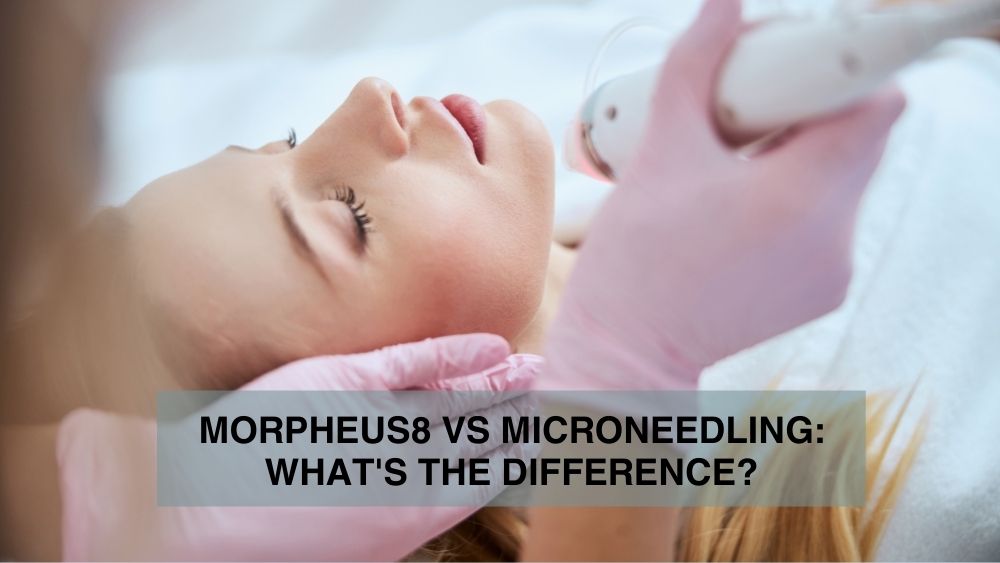 Morpheus8 vs Microneedling What's the Difference