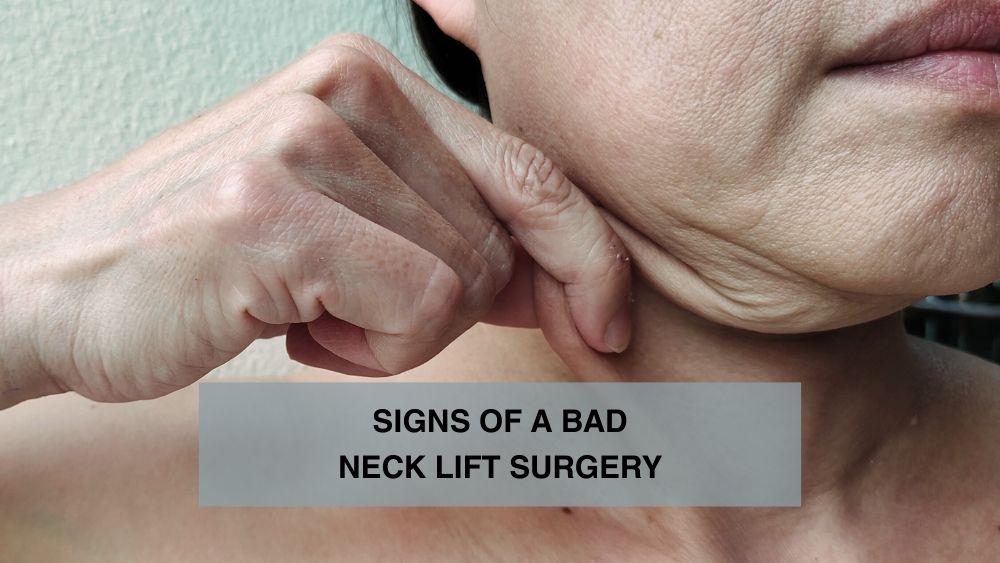 Signs of a Bad Neck Lift Surgery