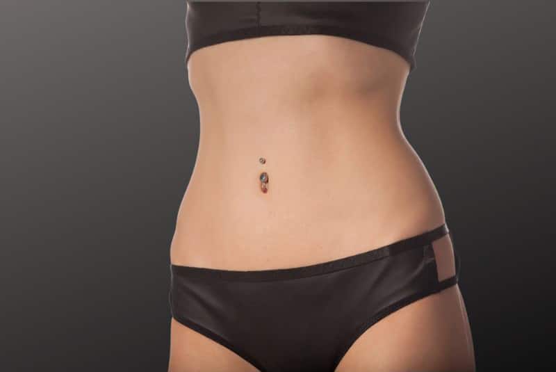 Tummy Tuck After Weight Loss What to Know