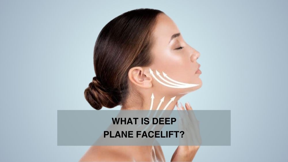 What Is Deep Plane Facelift?