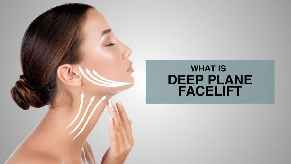 What Is Deep Plane Facelift