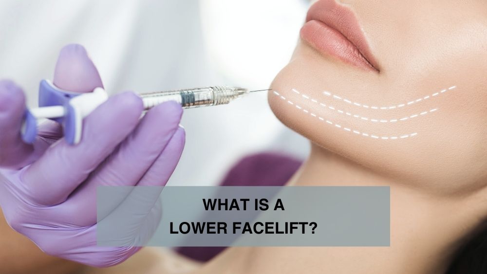 What Is a Lower Facelift?