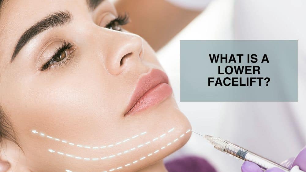 What Is a Lower Facelift