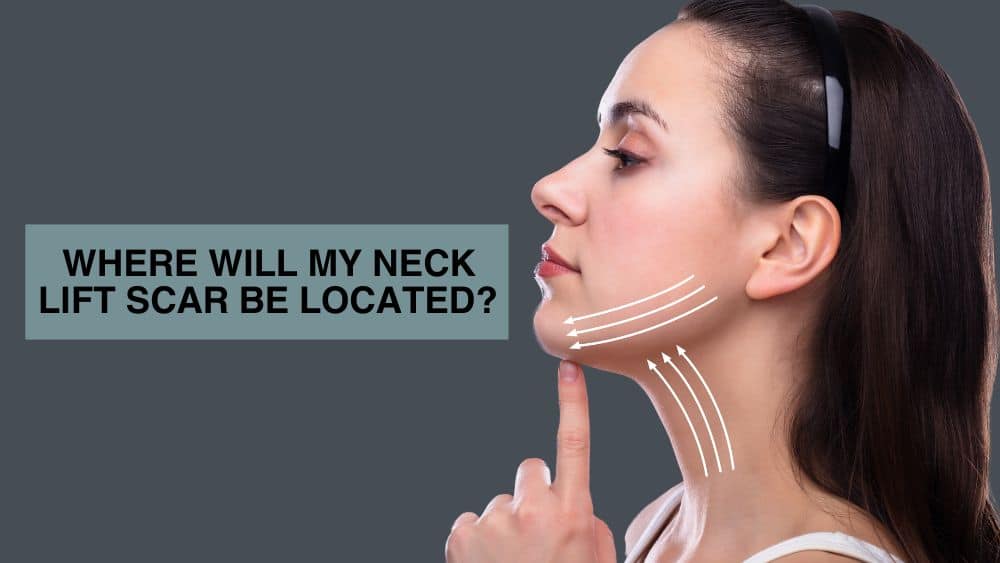 Where Will My Neck Lift Scar Be Located