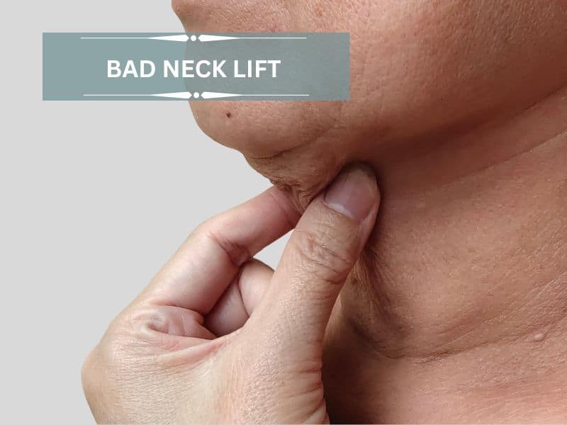 bad neck lift