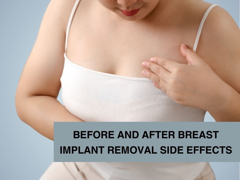 before and after breast implant removal side effects