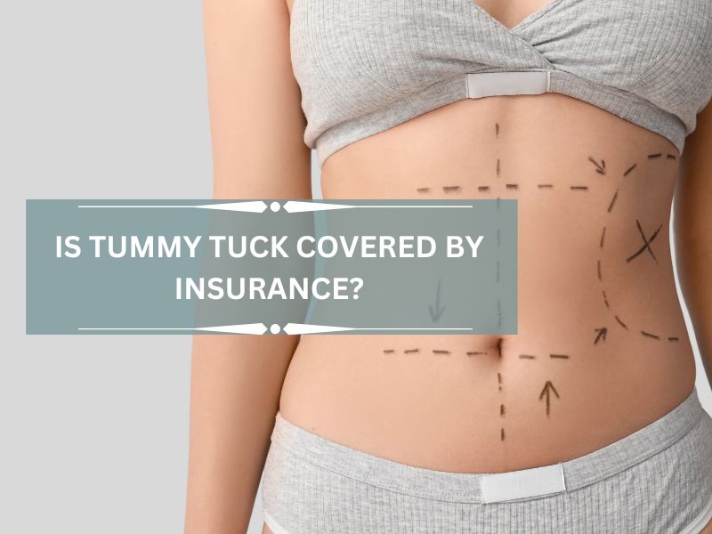 is tummy tuck covered by insurance