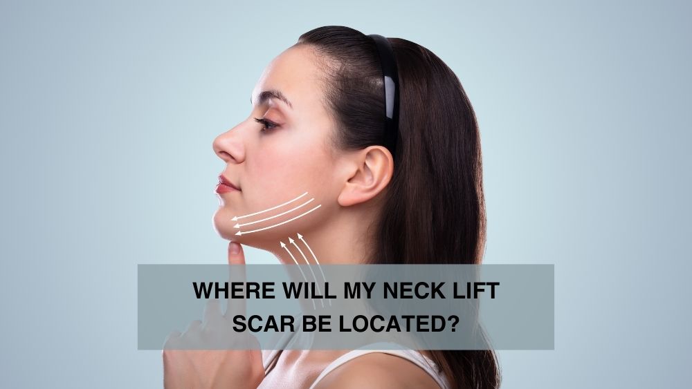 Where Will My Neck Lift Scar Be Located?