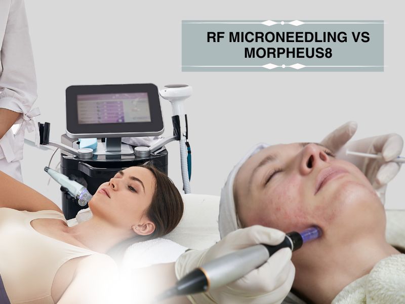 rf microneedling vs morpheus8