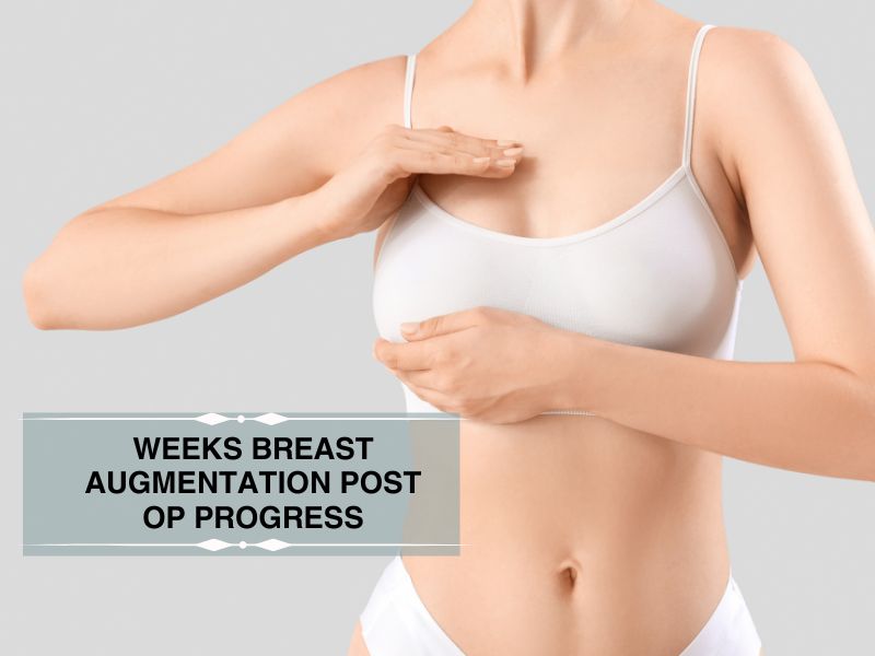 weeks breast augmentation post op progress